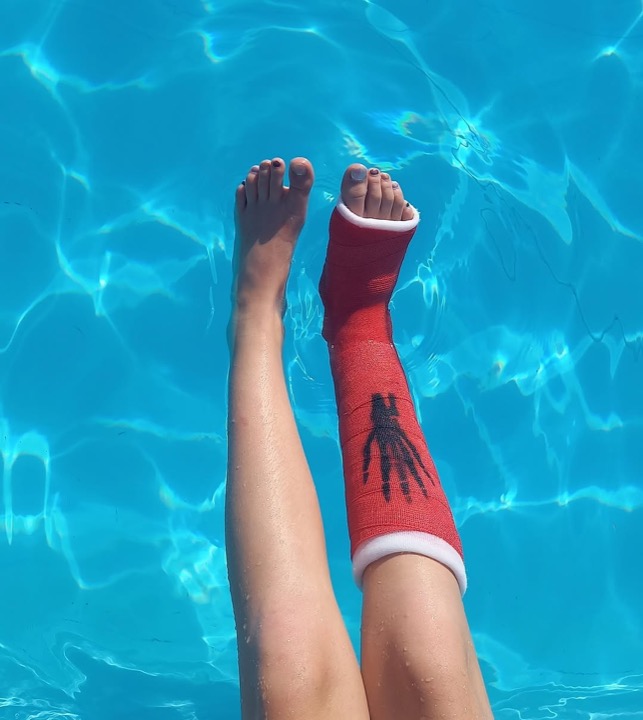 Rotes Schwimmgips-Bein im Pool