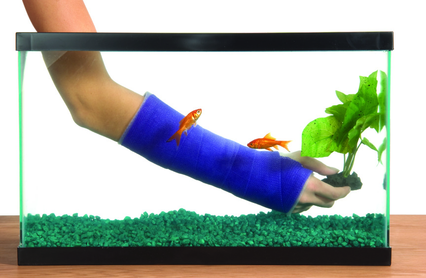 Arm mit Gips im Wasser eines Aquariums
